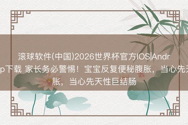 滚球软件(中国)2026世界杯官方IOS|Android手机app下载 家长务必警惕!宝宝反复便秘腹胀,当心先天性巨结肠