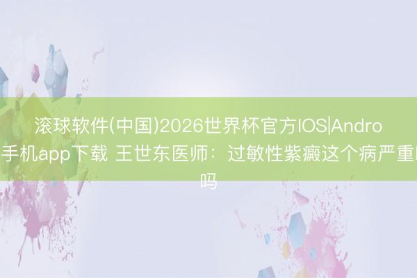 滚球软件(中国)2026世界杯官方IOS|Android手机app下载 王世东医师：过敏性紫癜这个病严重吗