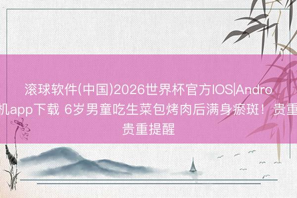 滚球软件(中国)2026世界杯官方IOS|Android手机app下载 6岁男童吃生菜包烤肉后满身瘀斑！贵重提醒